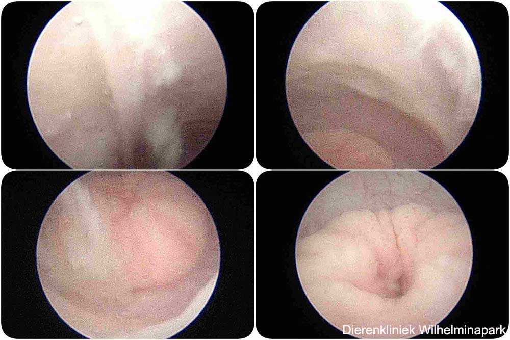 Als de vagina schoon is komt de cervix in beeld.